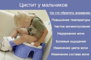 Лечение цистит у подростка