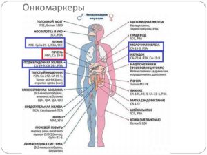 Онкомаркеры почек какие