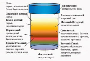 Какого цвета должна быть моча у грудничка в 2 месяца