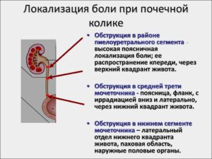 Как снять ноющую боль в почках