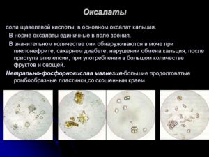 Что такое оксалаты