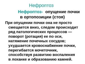 Опущение почки на 5 см опасно ли это причины