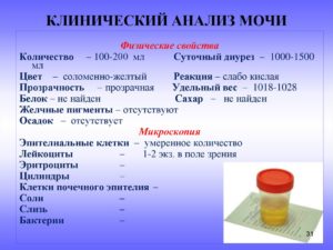 Количество мочи для общего клинического анализа в мл