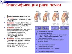 Рак почек 3 стадия сколько живут