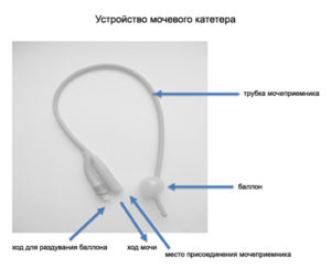 Как правильно промывать катетер из мочевого пузыря