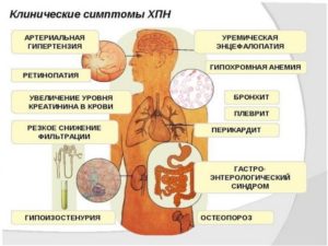 Перегрузка почек симптомы