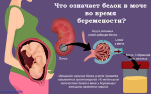 Много белка в моче у беременной