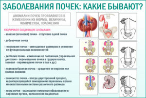 Почки какие болезни бывают