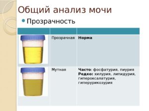 Какое количество мочи достаточно для анализа