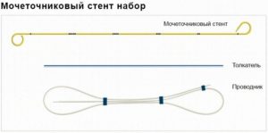 Для чего стенд в почке