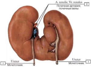 Двойная почка у младенца