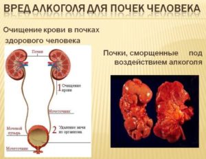 Можно ли алкоголь при больных почках