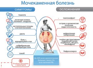 Как снять приступ при мочекаменной болезни