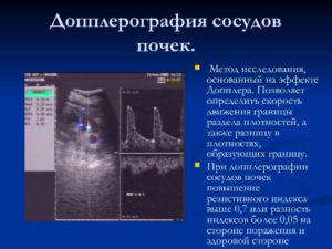 Как проверить сосуды в почках