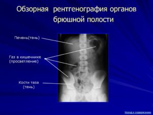 Обзорная рентгенография это