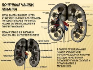 Почему расширяются чашечки в почках