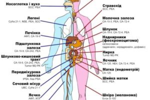 Онкомаркеры почек какие