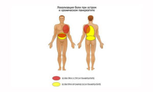 Как отличить боль в почке от боли в поджелудочной железе