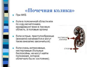 Мочекаменная болезнь почечная колика слева