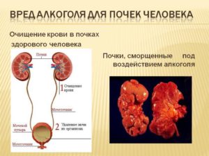 Чем почистить почки после алкоголя