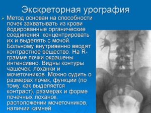 Подготовка к урографии почек фортранс