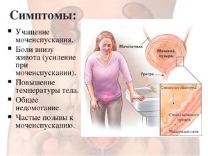 Болит низ живота и хочется в туалет по маленькому