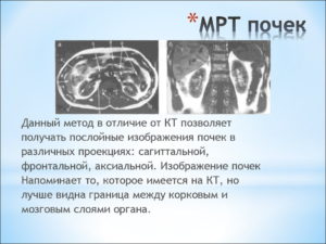 Чем отличается кт от мрт почек