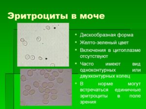 Эритроциты в моче 10 у женщины