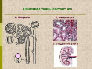 Что такое интерстициальная ткань почки