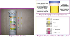 Нитриты в моче у мужчин что это значит