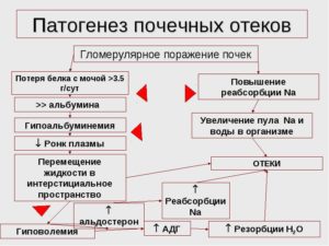 Патогенез почечных отеков