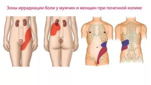 Левая почка болит уже неделю