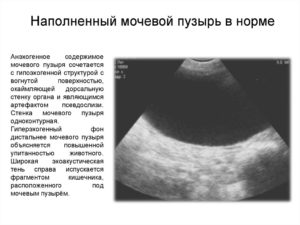 Сколько по времени наполняется мочевой пузырь