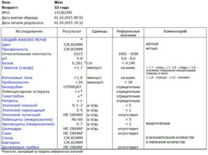 Анализ мочи при уретрите у женщин показатели