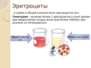 Антибиотики кровь в моче