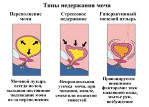 Проблемы со стулом к какому врачу обратиться