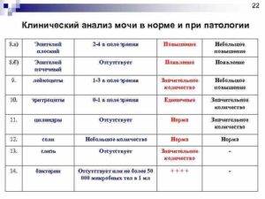 Эпителий плоский в моче 2 4