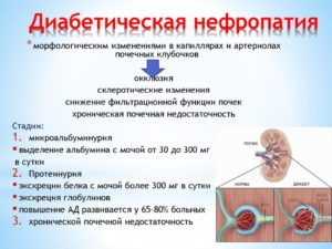 Нефропатия почек симптомы лечение