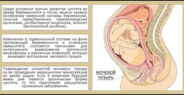Беременность после цистита