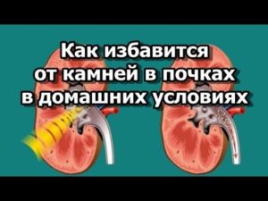 Как избавиться от камней в почках народные средства