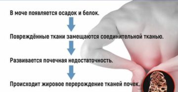 Болят почки после пива лечение