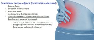 Какие симптомы когда болят почки у женщин