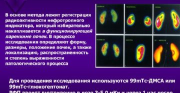 Сцинтиграфия почек в москве детям
