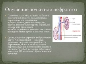 Опущение почки на 5 см опасно ли это причины