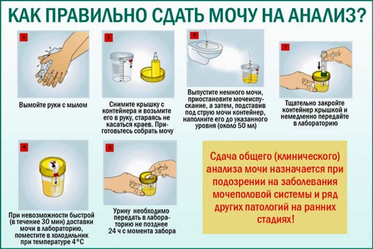 Правила сбора мочи на анализ