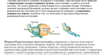 Удалили мочевой пузырь как жить дальше