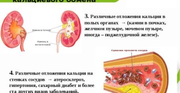 Кальций оседает в почках