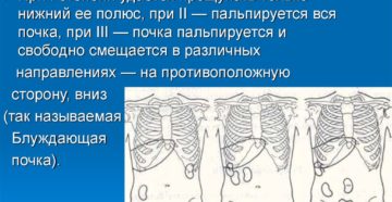 Опущение почек чем грозит