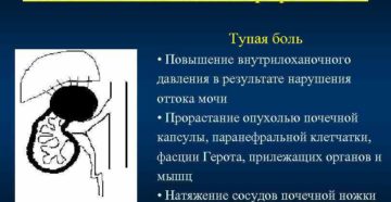 Боли при раке почки
