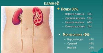 Почки средняя чашечка